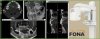 Panoramic Dental CT Radio 3D Panoramic Dental CT Radio 3D