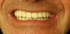 Nouvelles dents de Pascal C. Nouvelles dents de Pascal C.