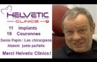 Implants dentaires