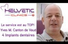 Implants dentaires et Sinus Lift