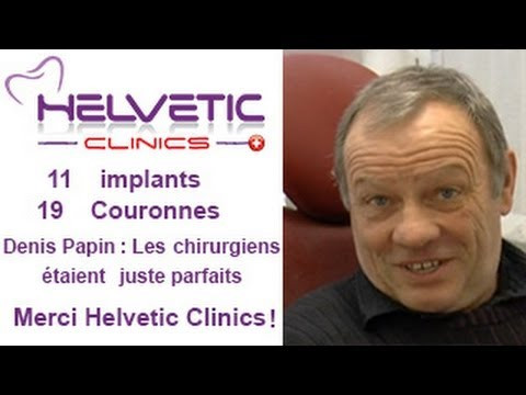 Implants dentaires